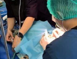 Peringati HJC ke-349, RSUD Cimacan Gelar Bakti Sosial Operasi Celah Bibir dan Langit-Langit