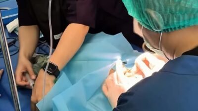 Peringati HJC ke-349, RSUD Cimacan Gelar Bakti Sosial Operasi Celah Bibir dan Langit-Langit