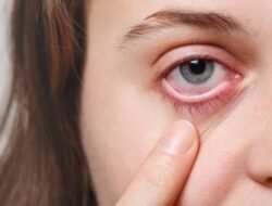 10 Penyebab Mata Perih yang Perlu Diketahui, Jangan Diabaikan