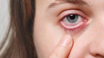 10 Penyebab Mata Perih yang Perlu Diketahui, Jangan Diabaikan