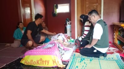 Dua Tahun Mengalami Kelumpuhan, Erik 14 Tahun Akhirnya Dapat Penanganan di RS Bunut Sukabumi